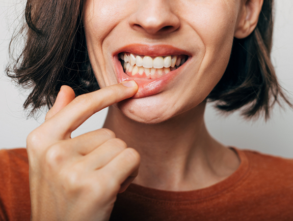 Woman pointing to her gums after gum disease treatment in Port Chester