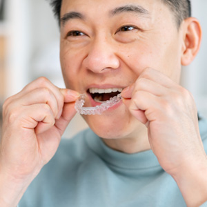 Patient putting on clear aligner