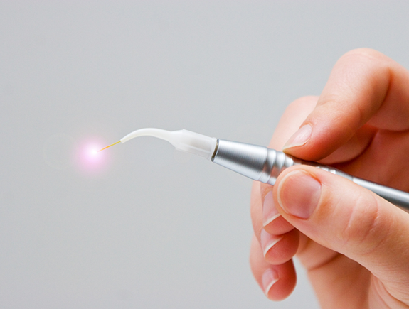 Hand holding a pen like laser device for laser assistant periodontal treatment in Port Chester