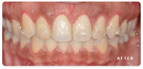 after image