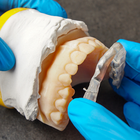 Dentist placing a clear tray over a row of teeth in a model of the mouth