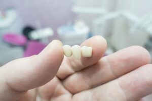 Thumb and forefinger holding dental bridge in dental office